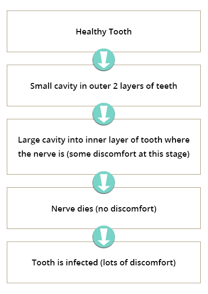 Root Canal: Tooth Decay Progression