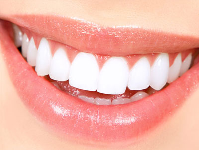 Dental Whitening